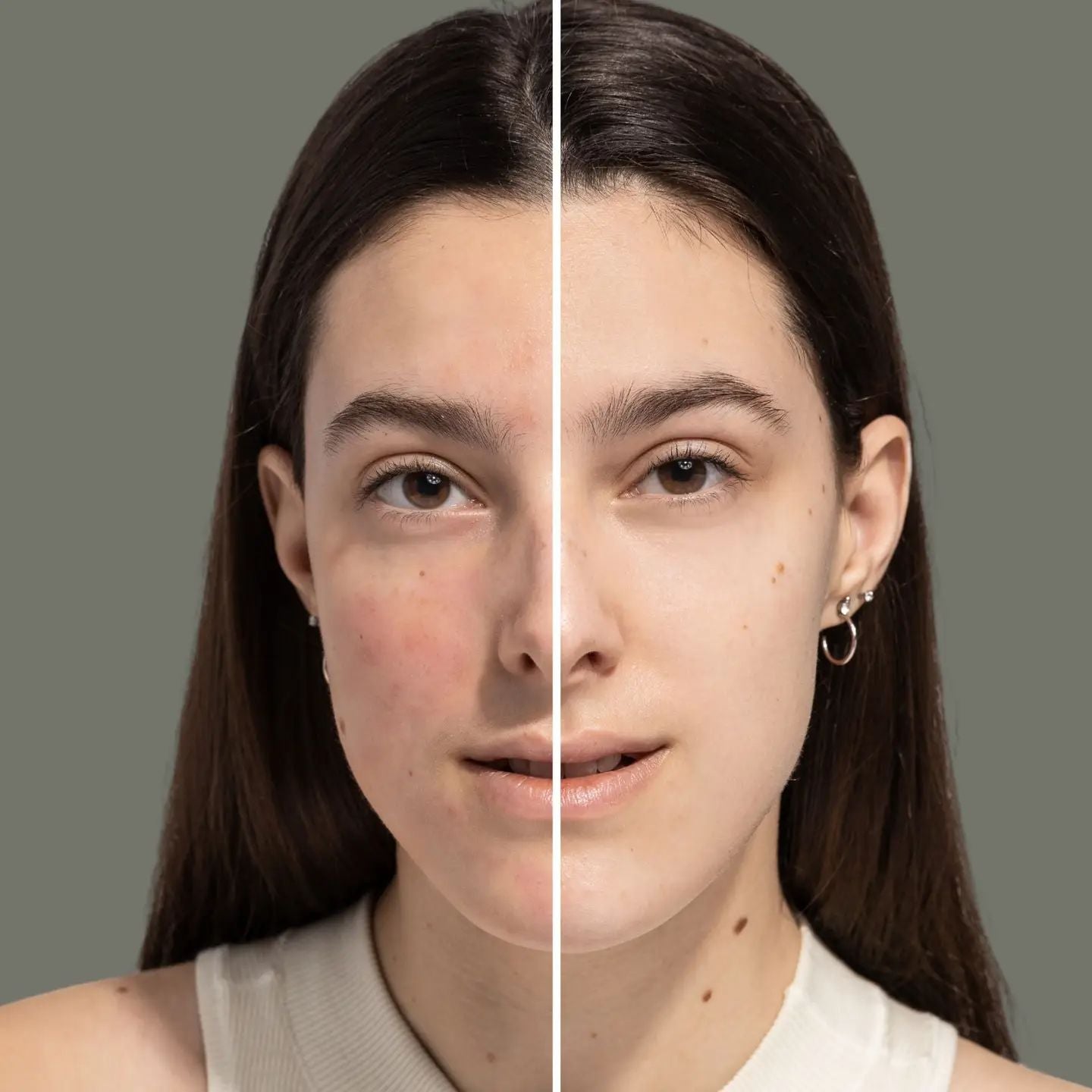 Redness Rescue Cream | FITGLOW