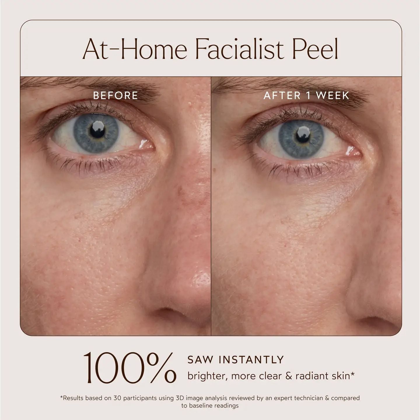 At-Home Facialist Peel | TRUE BOTANICALS