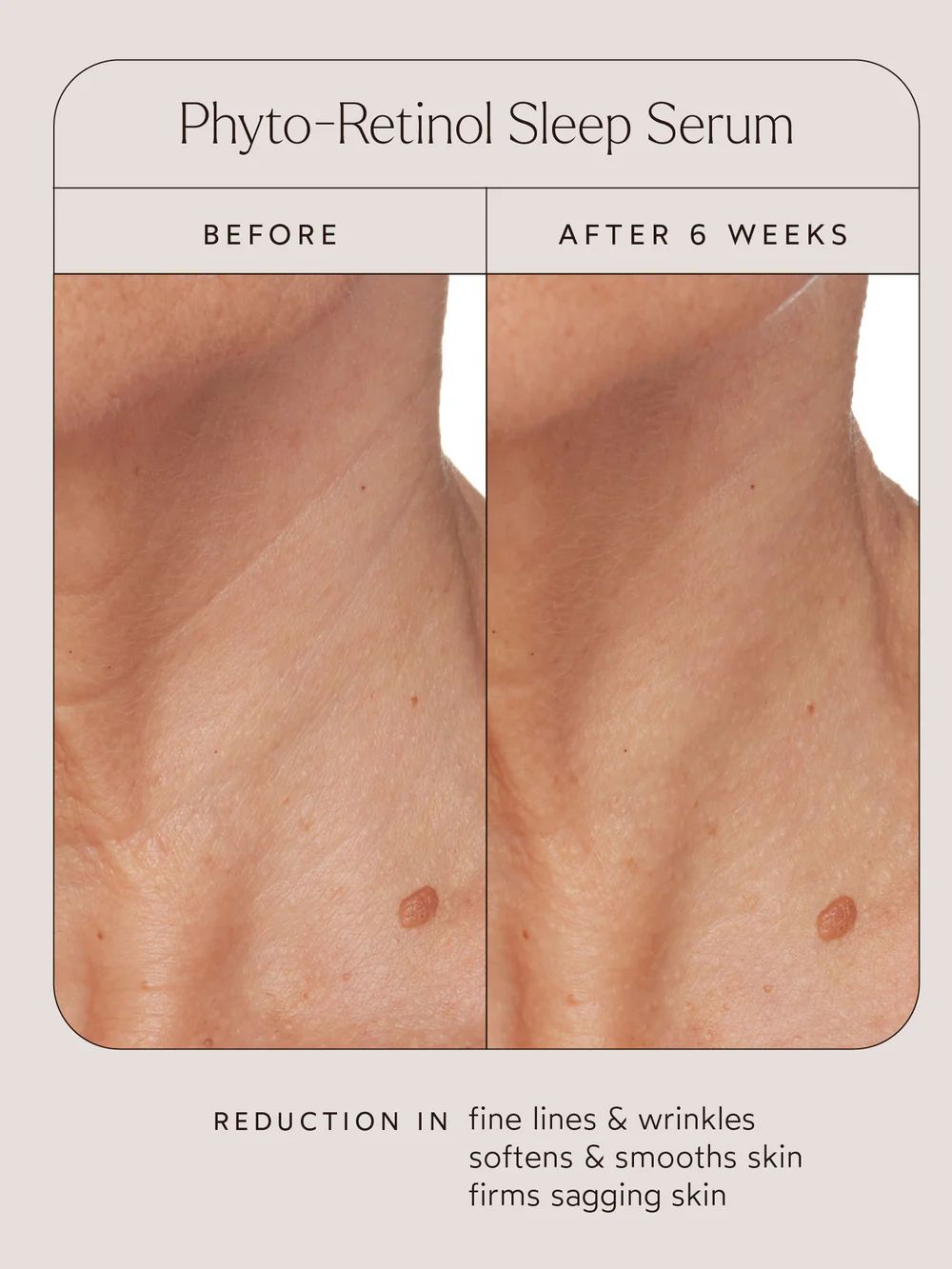 Phyto-Retinol Sleep Serum | TRUE BOTANICALS