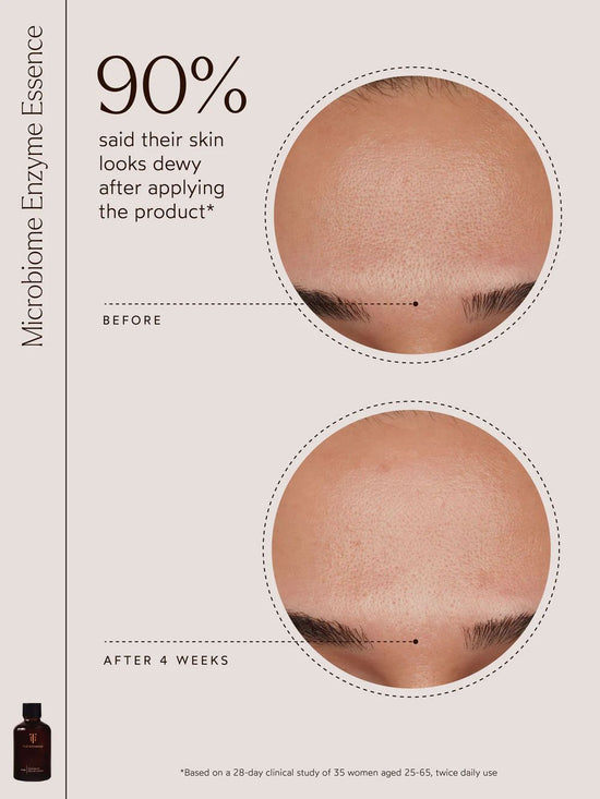 Renew Microbiome Enzyme Essence | TRUE BOTANICALS