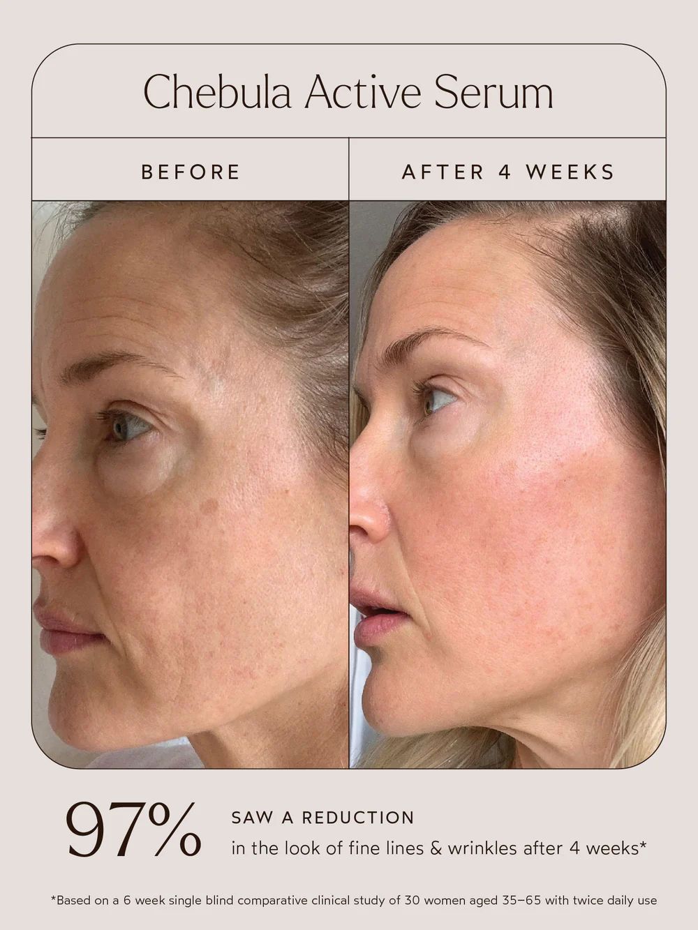 Renew Chebula Active Serum | TRUE BOTANICALS