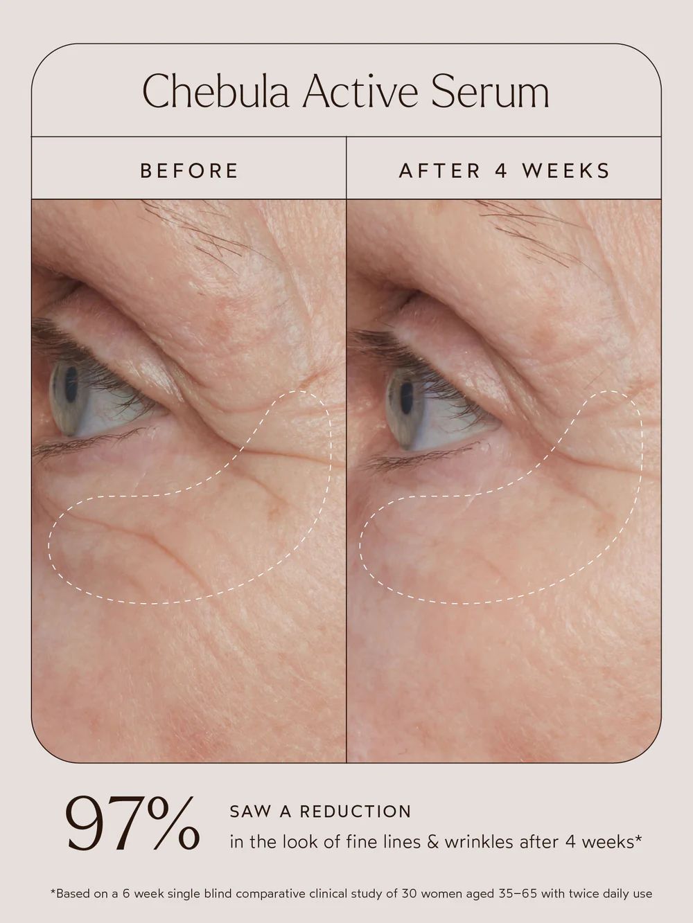 Renew Chebula Active Serum | TRUE BOTANICALS