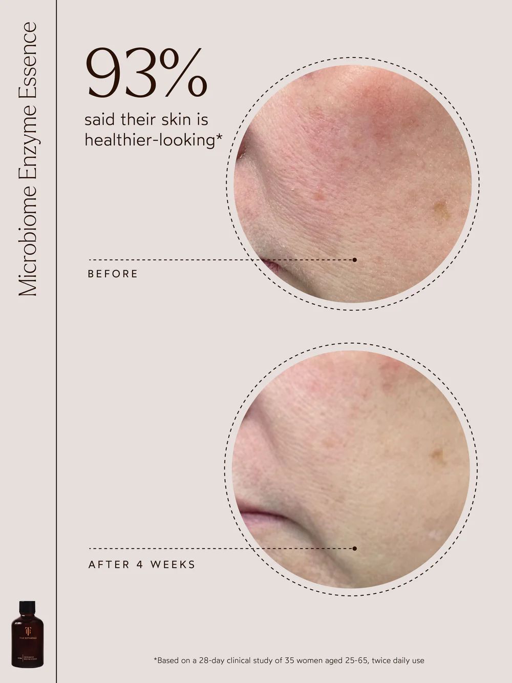 Renew Microbiome Enzyme Essence | TRUE BOTANICALS