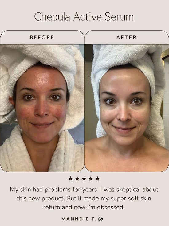 Renew Chebula Active Serum | TRUE BOTANICALS