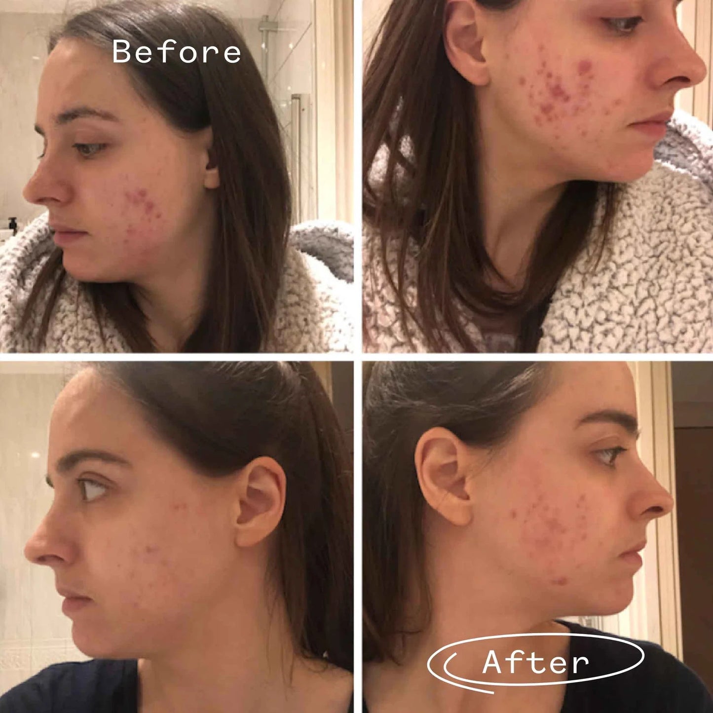 Instant Kalmer | PAI SKINCARE