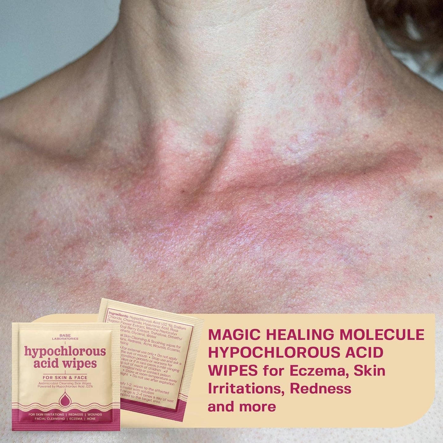 Hypochlorous Acid Facial Wipes | BASE LABORATORIES