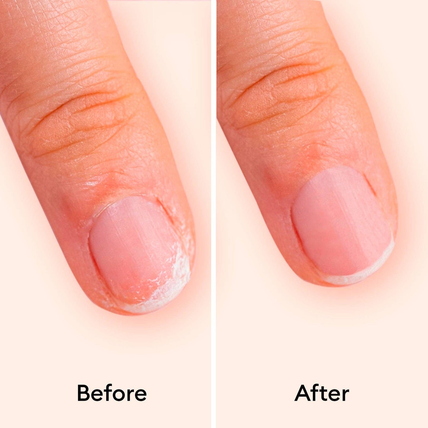 Keratin Booster | MANUCURIST